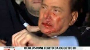 Berlusconi resta in osservazioneE’ in ospedale dopo l’aggressione