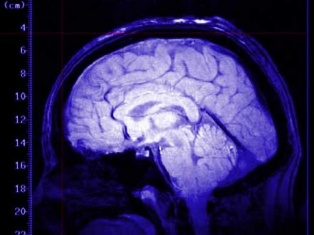 Cellule per curarei traumi cerebrali